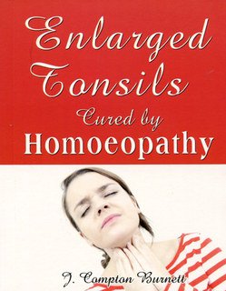 (image for) Enlarged Tonsils Cured by Homeopathy